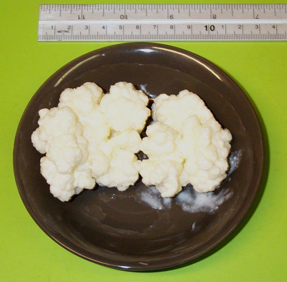 Milk kefir grains laid out beside a ruler — the cauliflower-like lobes, and their real size